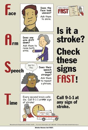 Stroke Rules